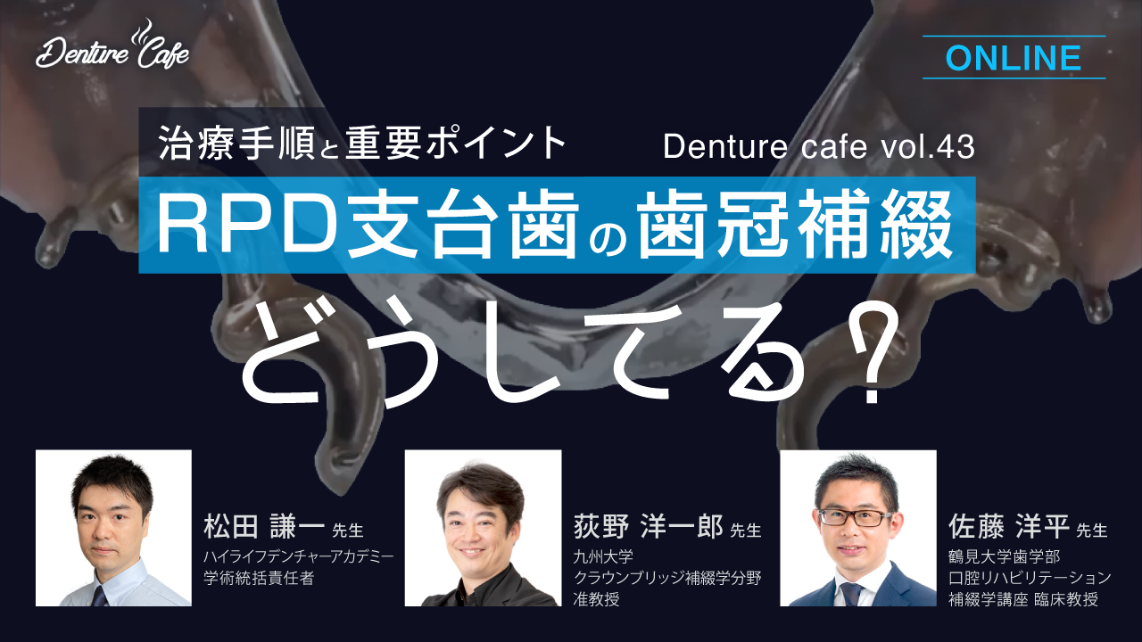 RPD支台歯の歯冠補綴、どうしてる？ 〜治療手順と重要ポイント〜｜Denture Cafe vol.43