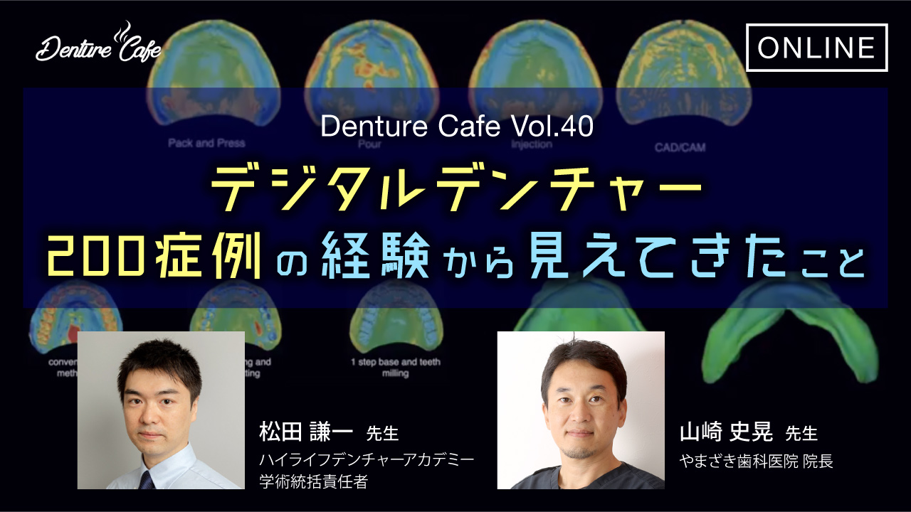 デジタルデンチャー、200症例の経験から見えてきたこと｜Denture Cafe vol.40