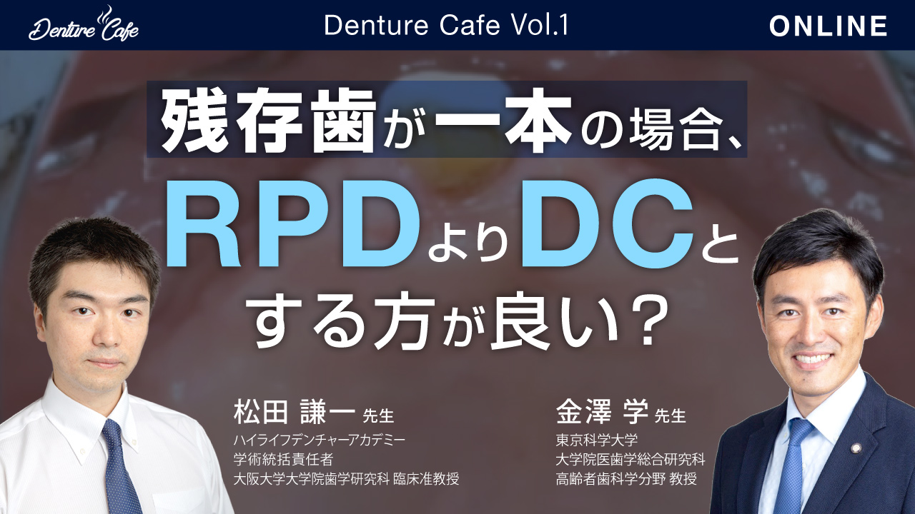 残存歯が一本の場合、RPDよりDCとする方が良い?|Denture Cafe vol.1