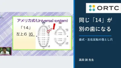 誤抜歯はなぜ起きる？歯式表記・左右反転・術前照合の落とし穴
