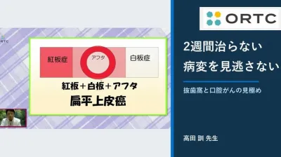 その歯、本当に抜いてよい？口腔がんの見逃しと2週間ルール