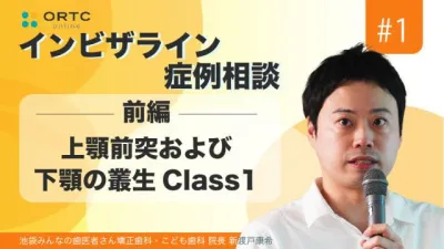 【期間限定無料公開】上顎前突および下顎の叢生Class1　前編