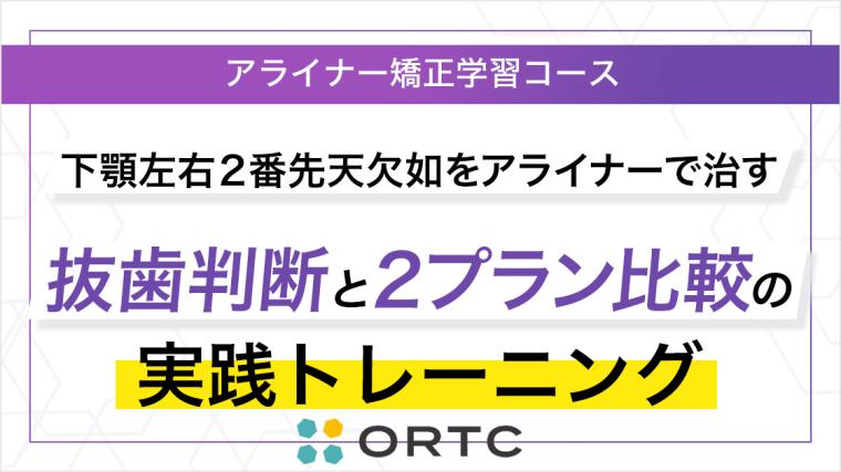 下顎左右2番先天欠如をアライナーで治す：抜歯判断と2プラン比較の実践トレーニング ORTC