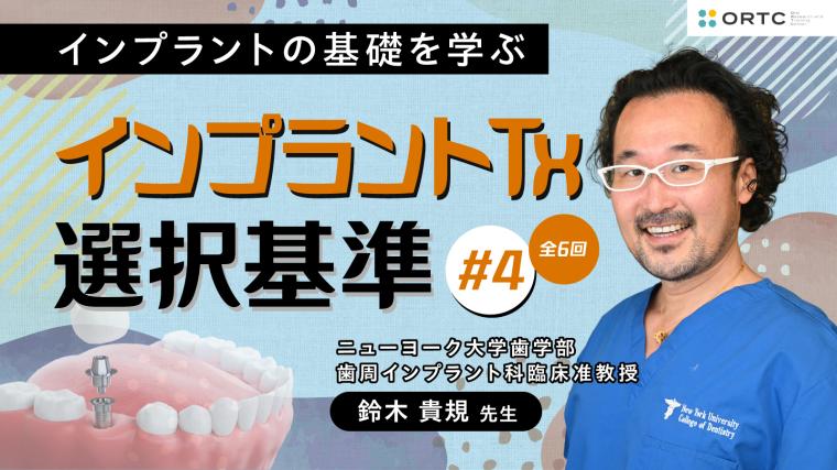 インプラントTx、選択基準 基礎編02_PART4