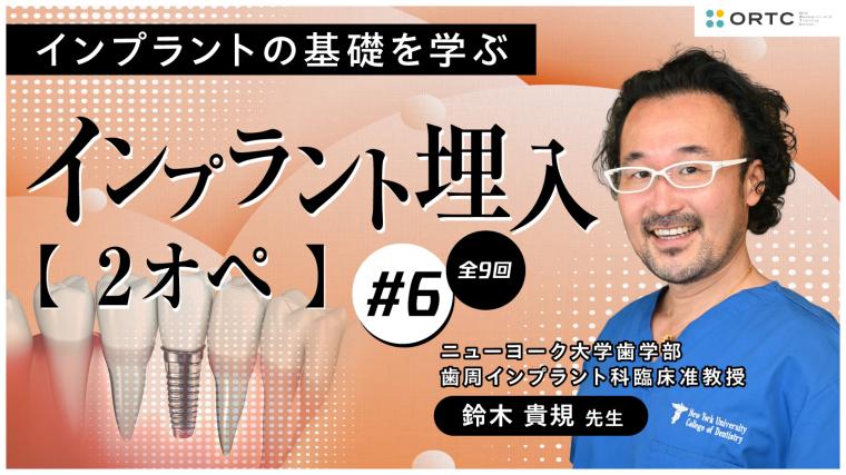 インプラント埋入2オペ　PART6