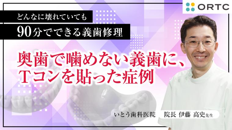 奥歯で噛めない義歯に、Ｔコンを貼った症例 伊藤高史