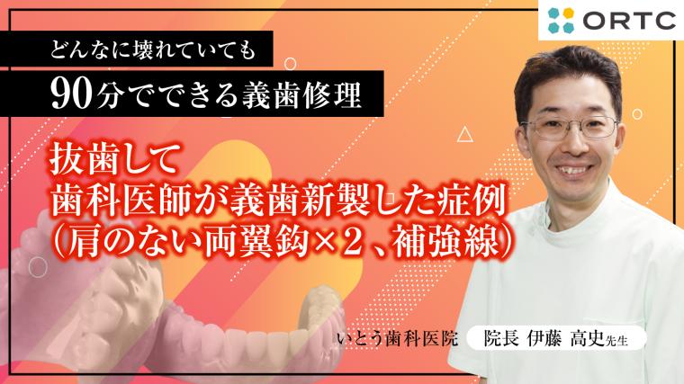 抜歯して歯科医師が義歯新製した症例（肩のない両翼鈎×２、補強線） 伊藤高史