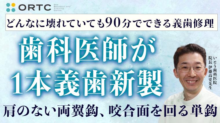 歯科医師が義歯新製（肩のない両翼鈎、咬合面を回る単鈎）