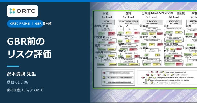 GBR前に押さえる保存・抜歯基準|治療リスクを見極める実践の基本