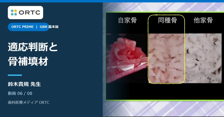 GBRの可能性と必要性 基本編｜適応判断と骨補填材 鈴木貴規
