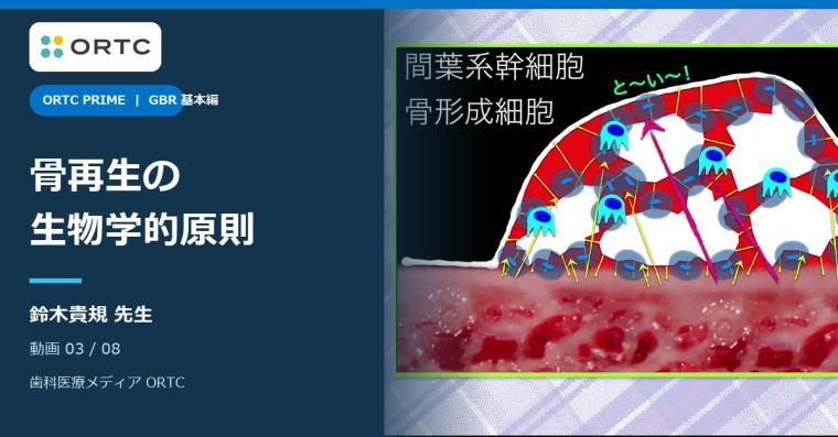 GBRの生物学的原則｜血餅の安定・固定・微小動揺を臨床で整理する