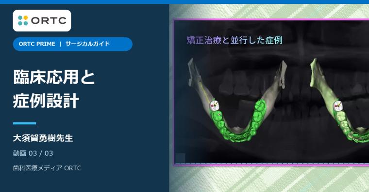 サージカルガイド｜臨床応用と症例設計