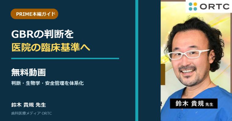 【無料動画】GBRの判断を医院の臨床基準へ｜PRIME本編ガイド