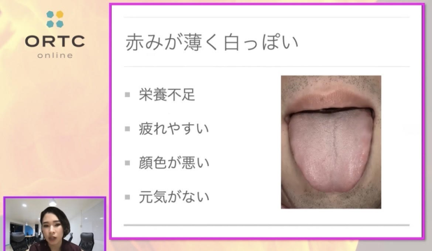 舌から見える身体のシグナル」のコンテンツ動画のご紹介｜ORTC歯科医療者向け動画学習サイト