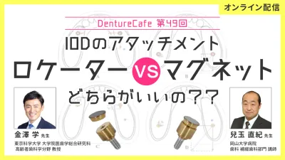 IODのアタッチメント、“ロケーターvsマグネット” どちらがいいの？？｜Denture Cafe vol.49