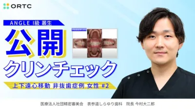 ANGLE　I級　叢生　上下遠心移動　非抜歯症例　女性