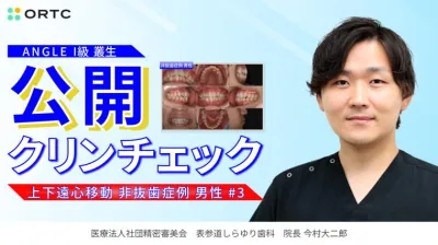 ANGLE　I級　叢生　上下遠心移動　非抜歯症例　男性