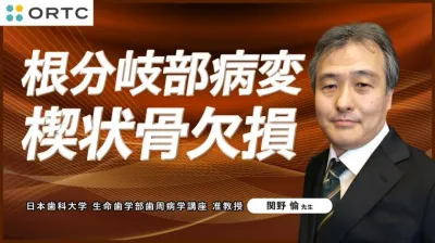 根分岐部病変 楔状骨欠損