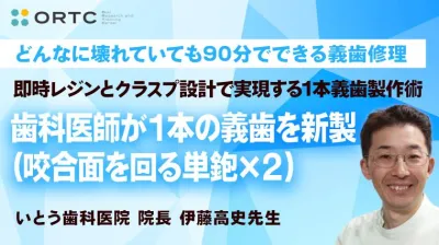 「即時レジンとクラスプ設計で実現する1本義歯製作術」歯科医師が１本の義歯を新製（咬合面を回る単鉋×２）