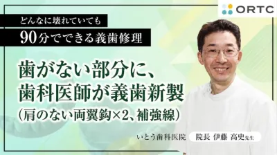 歯がない部分に、歯科医師が義歯新製（肩のない両翼鈎×２、補強線）