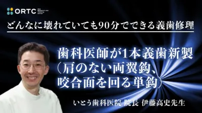 歯科医師が1本義歯新製 （肩のない両翼鈎、咬合面を回る単鈎）