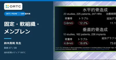 GBRの可能性と必要性 基本編｜固定・軟組織・メンブレン