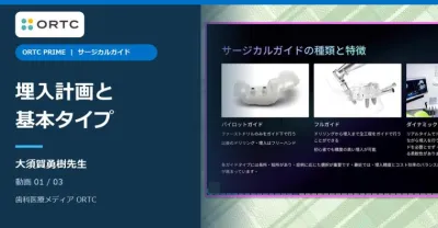サージカルガイド｜補綴主導の埋入計画と基本タイプ