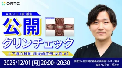 【公開クリンチェック】ANGLE　I級　叢生　上下遠心移動　非抜歯症例　女性