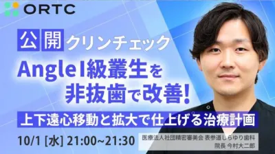 公開クリンチェック Angle1級叢生を非抜歯で改善！上下遠心移動と拡大で仕上げる治療計画