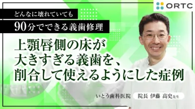 上顎唇側の床が大きすぎる義歯を、削合して使える…