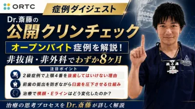 ダイジェスト | オープンバイトの症例について | …