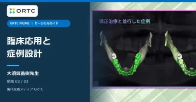 サージカルガイド｜臨床応用と症例設計