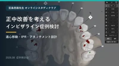 正中改善を考えるインビザライン症例検討|遠心移…