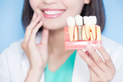 インプラント治療で起こりうる失敗とは？成功させ…