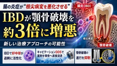 腸の炎症が“根尖病変を悪化させる”ことが判明