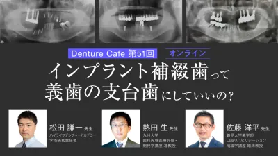 インプラント補綴歯って義歯の支台歯にしていいの？｜Denture Cafe vol.51