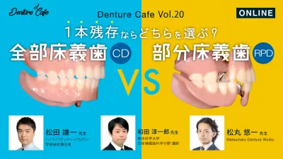 全部床義歯（CD）vs 部分床義歯（RPD） 〜1本残存ならどちらを選ぶ？～｜Denture Cafe vol.20