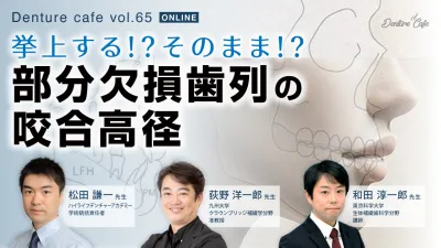 挙上する！？そのまま！？部分欠損歯列の咬合高径｜Denture Cafe vol.65