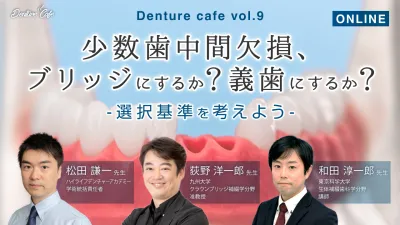 少数歯中間欠損、ブリッジにするか？義歯にするか？ 〜選択基準を考えよう〜｜Denture Cafe vol.9