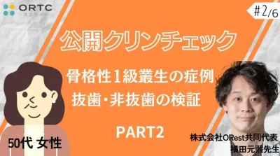 【インビザラインクリンチェック/矯正症例】50歳女性　骨格性1級叢生の症例　抜歯・非抜歯の検証 PART2