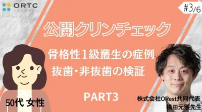 【インビザラインクリンチェック/矯正症例】50歳女性　骨格性1級叢生の症例　抜歯・非抜歯の検証 PART3