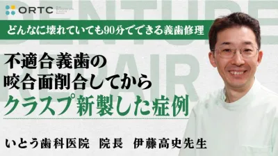 不適合義歯の咬合面削合してからクラスプ新製した症例