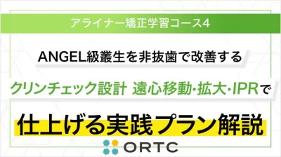 AngleⅠ級叢生を非抜歯で改善するクリンチェック設計 遠心移動・拡大・IPRで仕上げる実践プラン解説