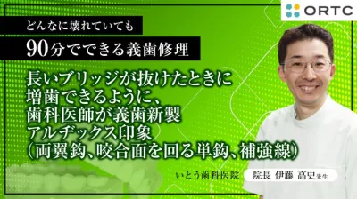 長いブリッジが抜けたときに増歯できるように、歯科医師が義歯新製　アルヂックス印象（両翼鈎、咬合面を回る単鈎、補強線）