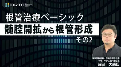 根管治療ベーシック　髄腔開拡から根管形成　その2