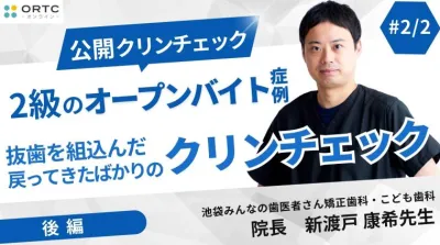 2級のオープンバイト症例_抜歯を組込んだ戻ってきたばかりのクリンチェック?