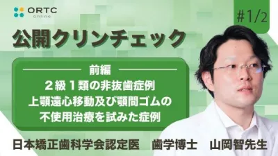 2級1類の非抜歯症例 上顎遠心移動及び顎間ゴムの不使用治療を試みた症例　前編