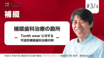 補綴歯科治療の勘所 Tooth wearに対する可逆的補綴歯科治療の例