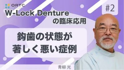 W-Lock Dentureの臨床応用　鈎歯の状態が著しく悪い症例