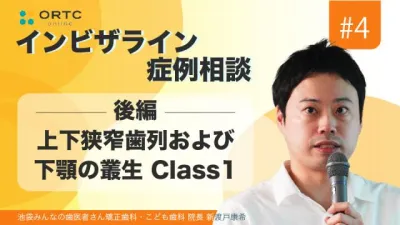 上下狭窄歯列および下顎の叢生 Class1 後編